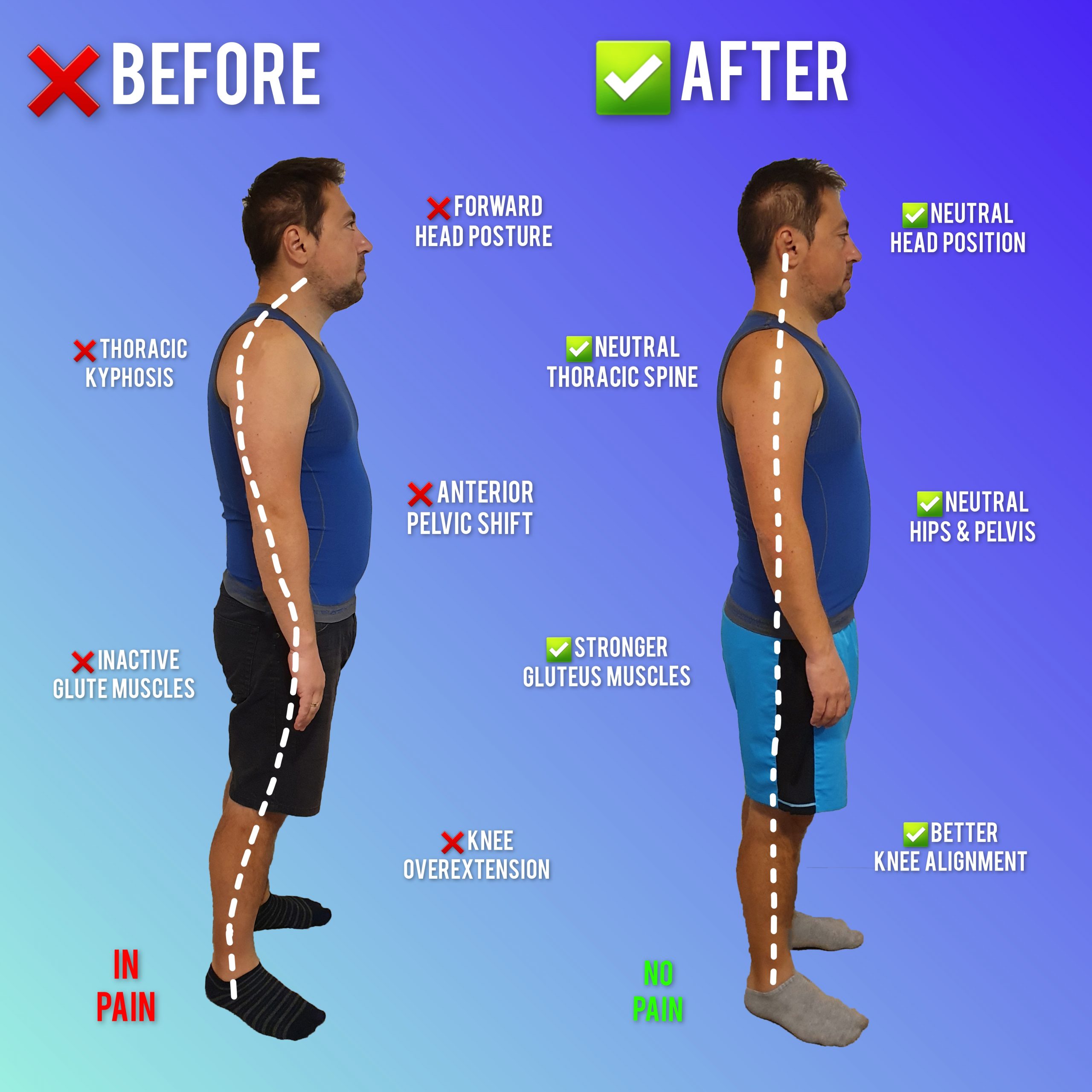 neck pain results and posture correction medical fitness MihaPower