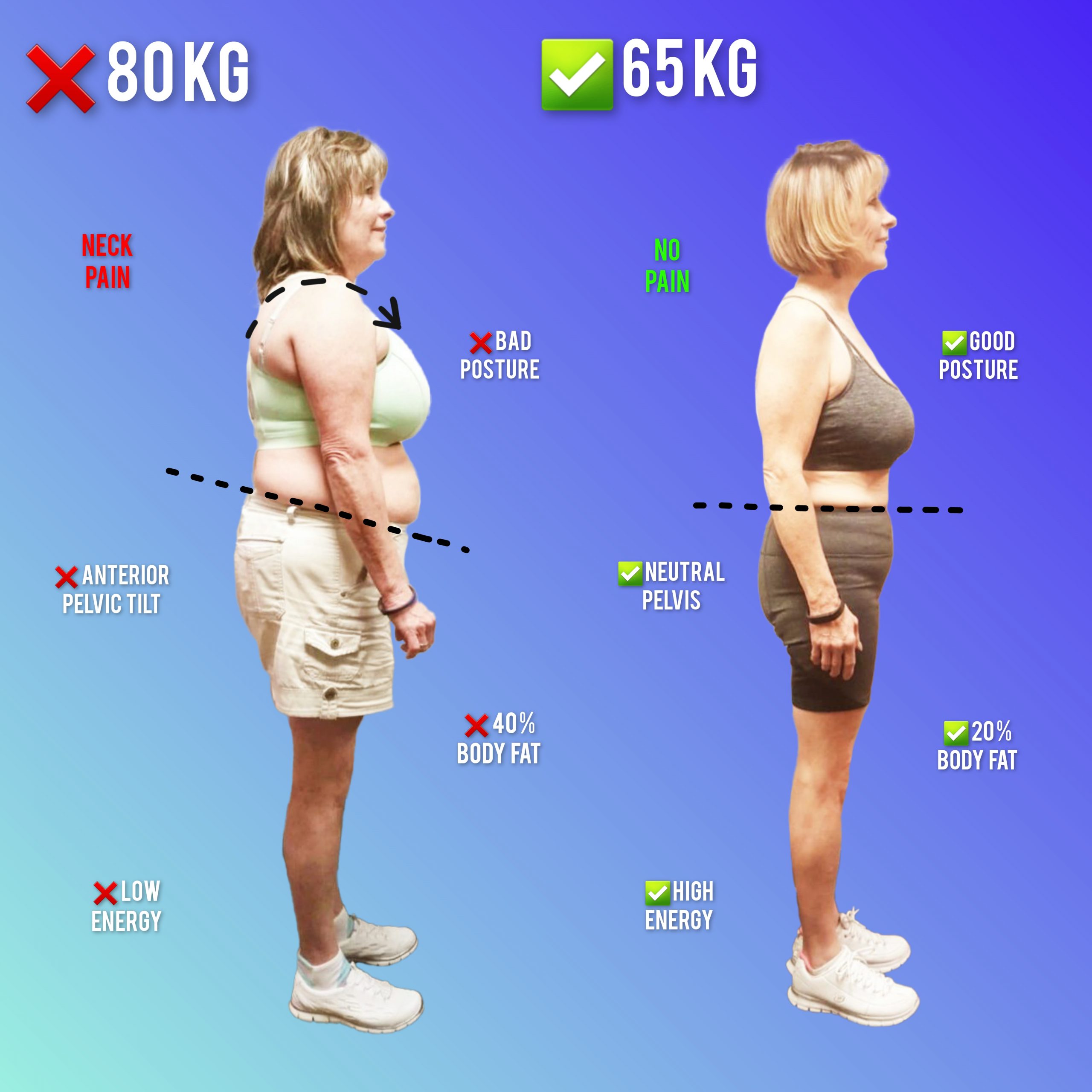 Weight loss and postural correction results MihaPower