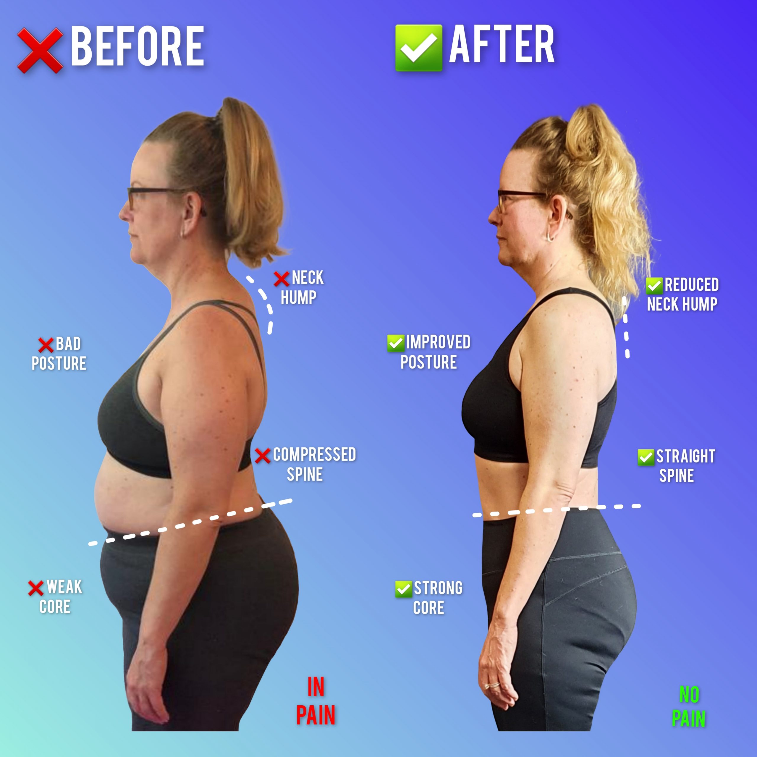 Weight loss and neck hump reduction MihaPower